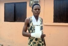 • Ernest Ntow, a victim short in the palm