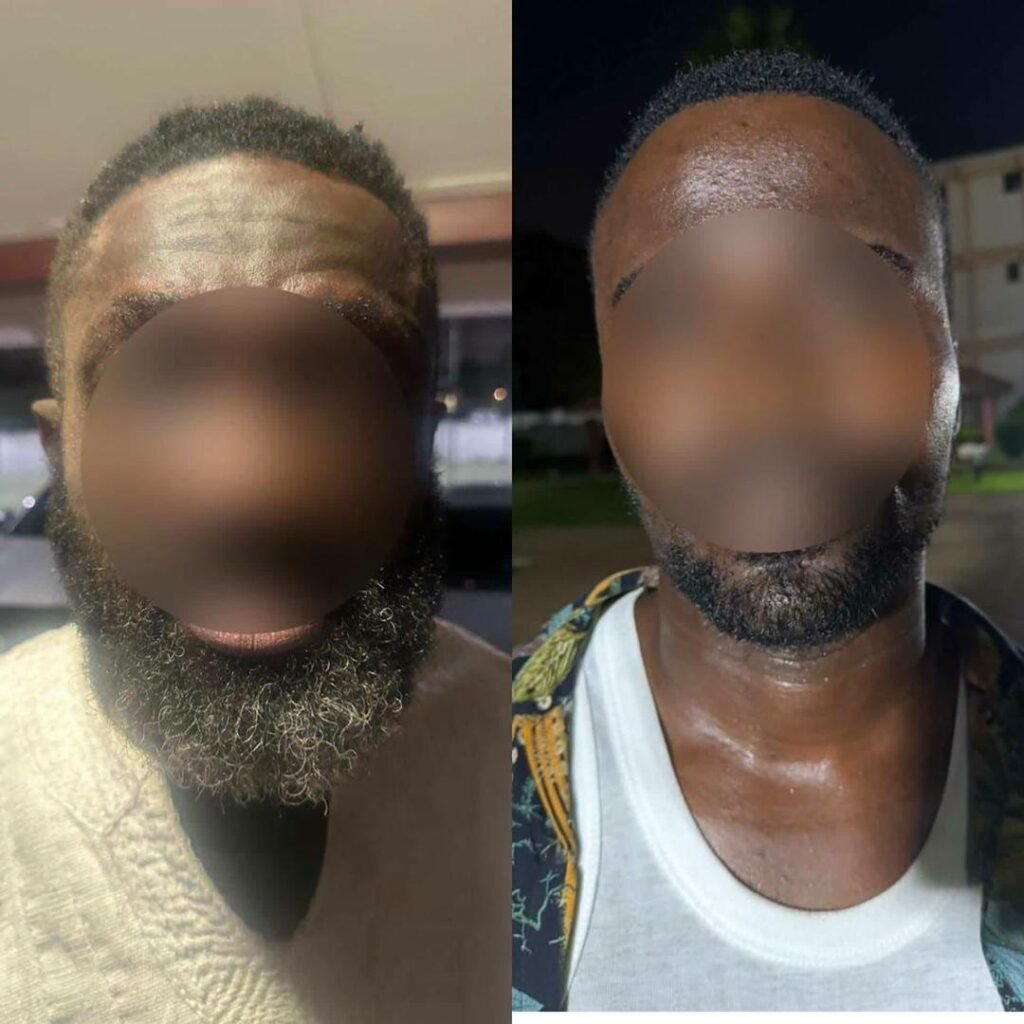Police records major breakthrough with arrest of 7 members of robbery syndicate